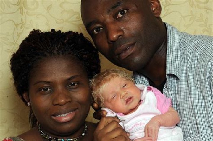 Black couple gives birth to a white baby