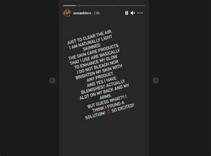 I do not bleach my skin: Former beauty queen Anna Banner clears the air