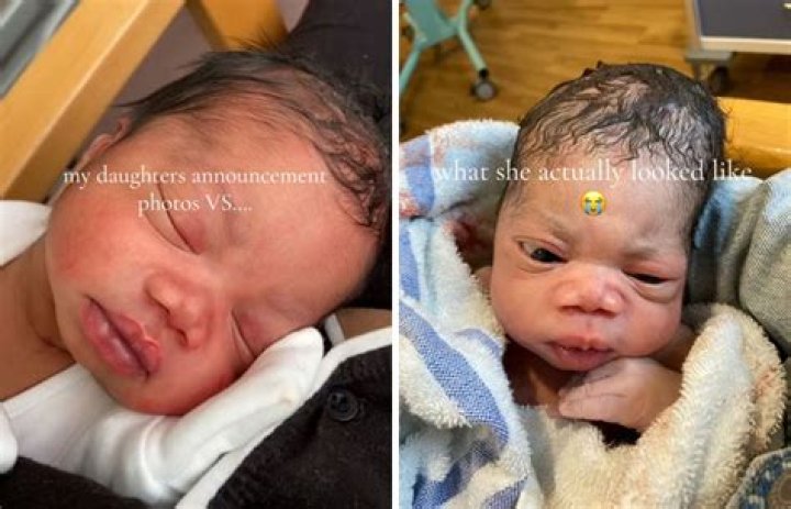 “I Was Worried”: Mother Shares Ugly Photos of Her Kid, New Transformation Video Causes Stir Online