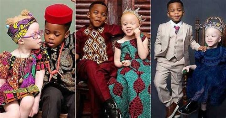 “I Thought I Was Given the Wrong Baby”: Mum Flaunts Black Son and Albino Twin Sister, Photos Trend