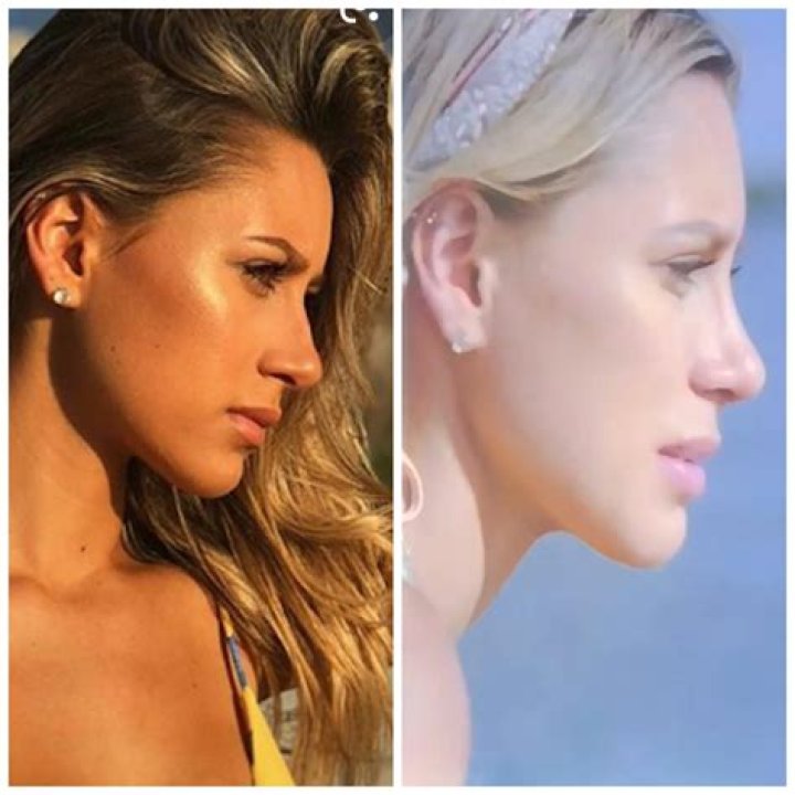 Did Cara From 'Siesta Key' Get a Nose Job? She Has a New Look