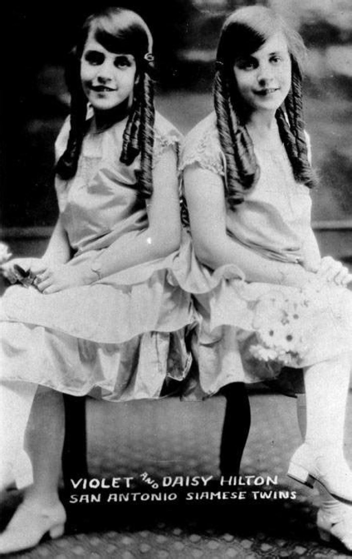 Daisy and Violet Hilton Net Worth