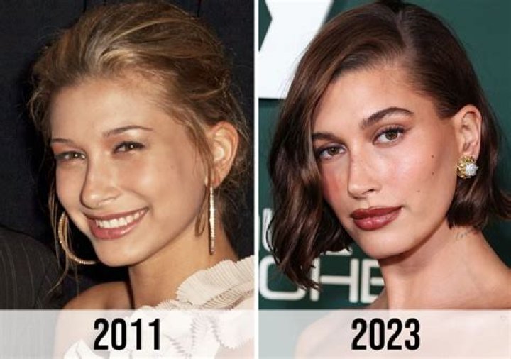 Rumors on Hailey Bieber’s Plastic Surgery — Threatened to Sue a Surgeon