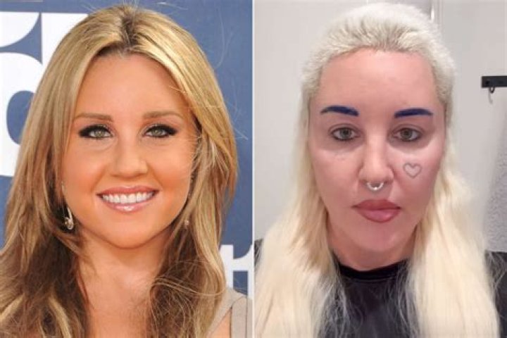 Has Thewizardliz Plastic Surgery? Before After Photo