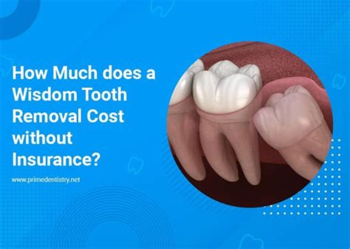 How Much Does It Cost to Bridge a Tooth?