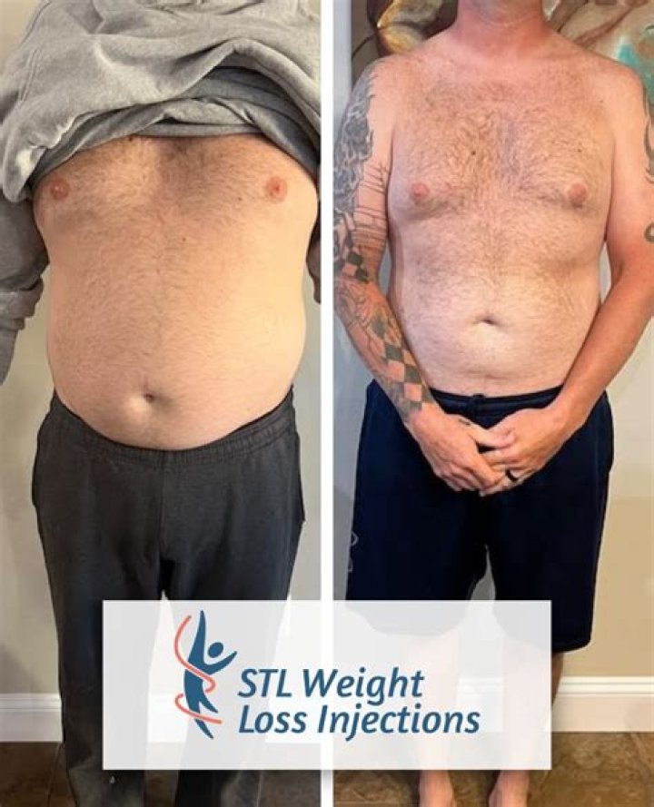 John Travolta Illness And Health Update: Weight Loss Details