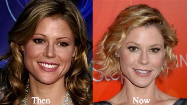 Did Julie Bowen Get Plastic Surgery – Here’s the Truth