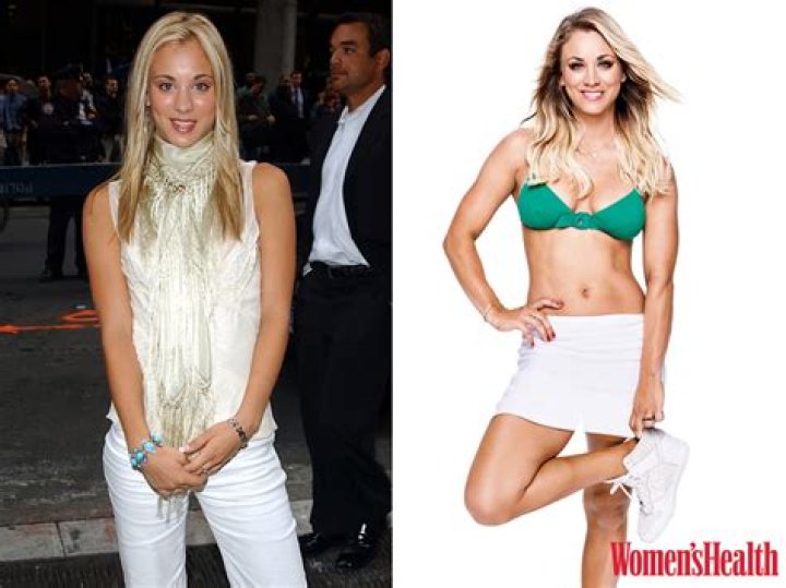 Kaley Cuoco Botox: Before And After Photos
