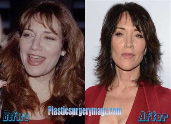 Katey Sagal’s Secret to Ageless Beauty: Is It Plastic Surgery?