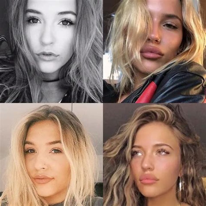 Are Lennon Stella's Lip Fillers Talks True? Inside Her Surgery, Family, and Net Worth