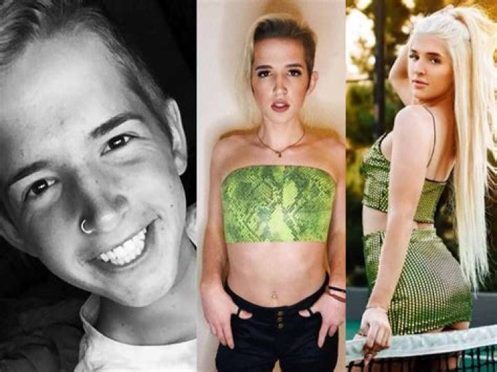 Lilah Gibney Before Surgery: Did She Get Top Or Bottom Surgery?