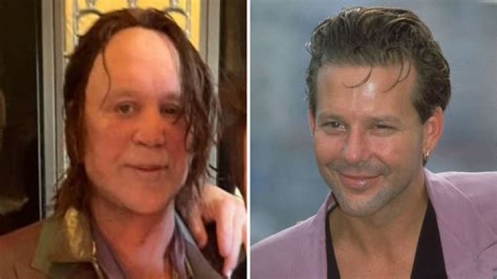Mickey Rourke’s History with Plastic Surgery Explained — What Happened to Him?