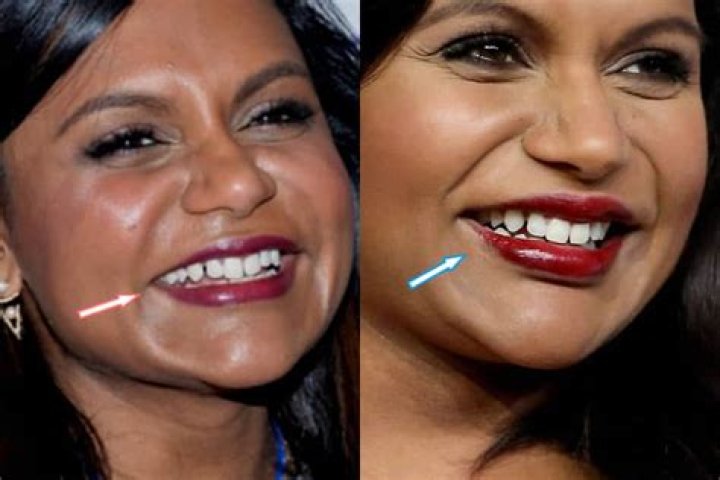 Mindy Kaling Teeth Before And After: More On Her Tattoo