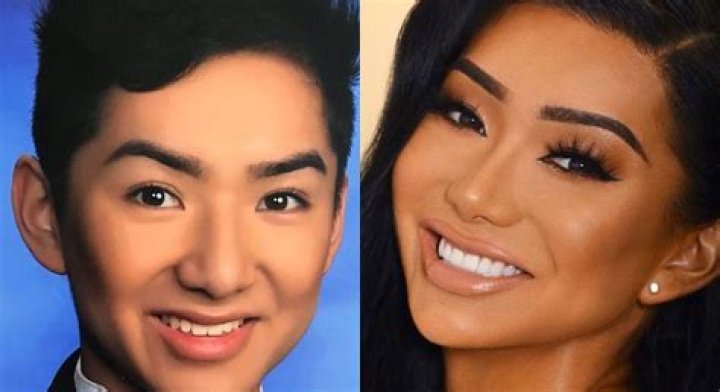 Before Surgery and After — A Look at Nikita Dragun’s Transformation