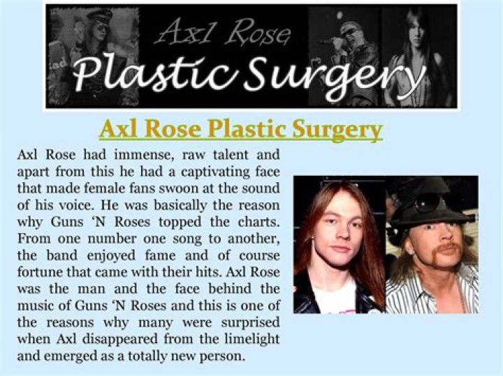 Photos: What Happened To Axl Rose Face? Plastic Surgery And Botox
