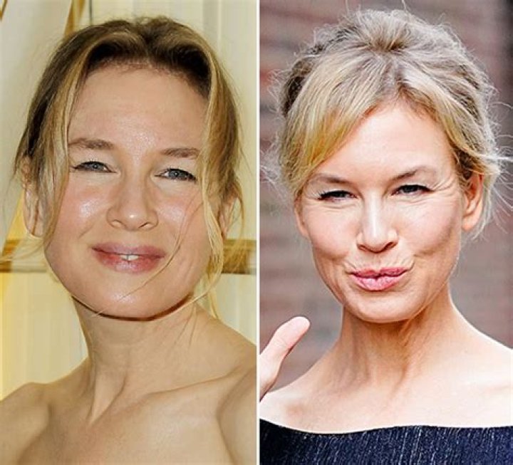 A Dive into Renee Zellweger’s Plastic Surgery Rumors and Her Response to Them over the Years