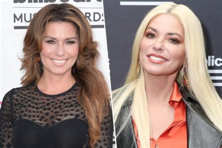 Shania Twain Facelift Surgery: Then And Now Photos