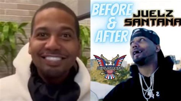 What Happened to Juelz Santana's Teeth? A Look at His Dental History