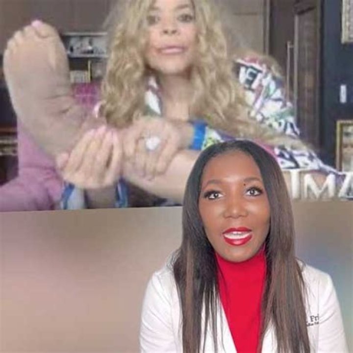 What Happened to Wendy Williams's Feet? Condition Explained