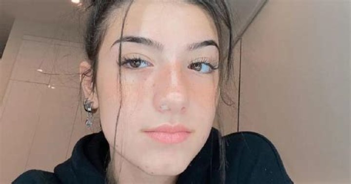 Charli D'Amelio Had Nose Surgery to Fix an Issue That Began Almost a Year Ago