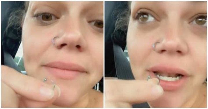 Woman Swallowed Nose Ring in Her Sleep — Pretty Common